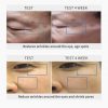 Dermaline PDX exosome PDRN Skin Booster before after