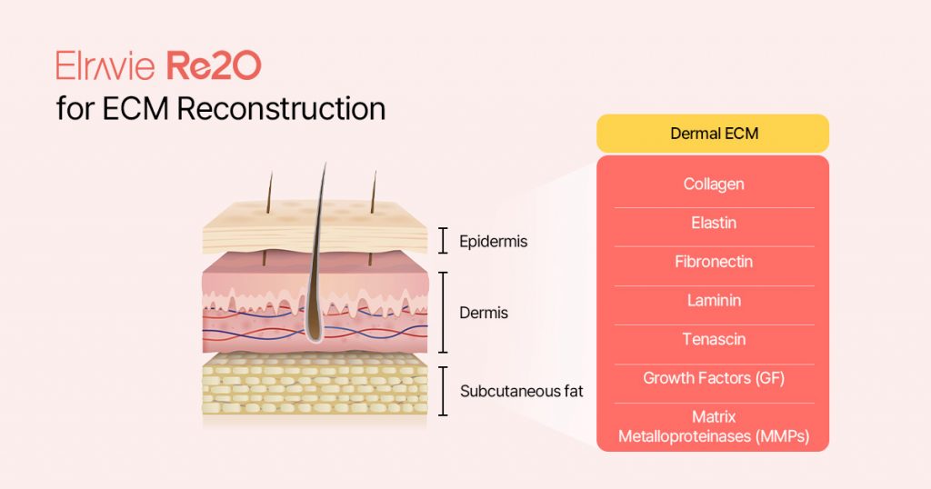 Elravie Re2O application