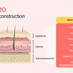 Elravie Re2O application